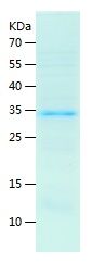    SESN2 / Recombinant Human SESN2