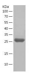    ERBB3 / Recombinant Human ERBB3