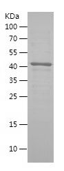    TXNIP / Recombinant Human TXNIP