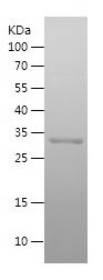    TOM40 / Recombinant Human TOM40