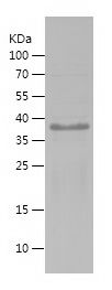    SIRT1-1 / Recombinant Human SIRT1-1