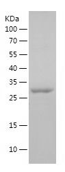    FER / Recombinant Human FER