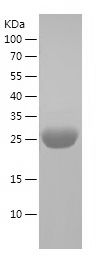    UCHL1 / Recombinant Human UCHL1