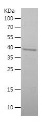    UCP1 / Recombinant Human UCP1