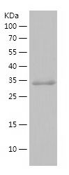    SDC3 / Recombinant Human SDC3