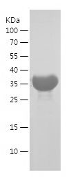    TOMM34 / Recombinant Human TOMM34