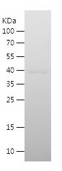    ZBTB11 / Recombinant Human ZBTB11