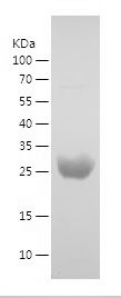    UCK2 / Recombinant Human UCK2