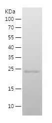    EPCAM / Recombinant Human EPCAM