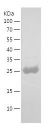    P24 / Recombinant Human P24