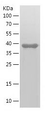    LPP / Recombinant Human LPP