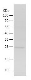    ING4 / Recombinant Human ING4