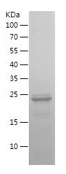    IRF5 / Recombinant Human IRF5