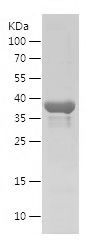    TMEM132A / Recombinant Human TMEM132A