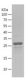    AXIN1 / Recombinant Human AXIN1