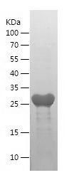    IRF9 / Recombinant Human IRF9