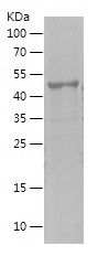    MAGEA1 / Recombinant Human MAGEA1