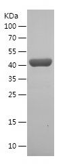    GOT1 / Recombinant Human GOT1