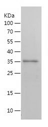    KDM2A / Recombinant Human KDM2A