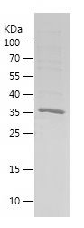    MAGEF1 / Recombinant Human MAGEF1