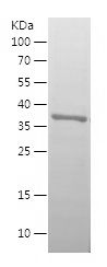    IGFBP3 / Recombinant Human IGFBP3