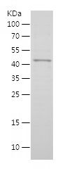    MAGEB1 / Recombinant Human MAGEB1