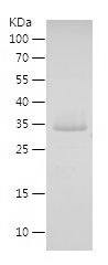    FBLIM1 / Recombinant Human FBLIM1