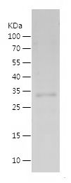    MAGBD2 / Recombinant Human MAGBD2