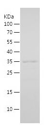    ING2 / Recombinant Human ING2