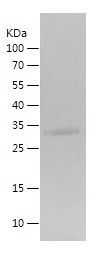    CGA / Recombinant Human CGA