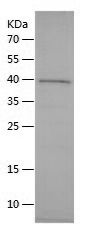    GYPA / Recombinant Human GYPA