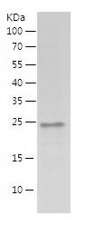    MED19 / Recombinant Human MED19