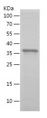    GP73 / Recombinant Human GP73