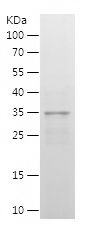    IRF2 / Recombinant Human IRF2