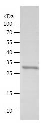    FUS / Recombinant Human FUS