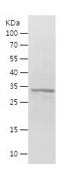    MLF1 / Recombinant Human MLF1