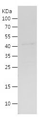    MLL5 / Recombinant Human MLL5