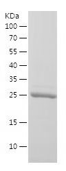    GSTP1 / Recombinant Human GSTP1