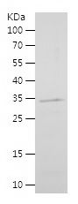    LEF1 / Recombinant Human LEF1