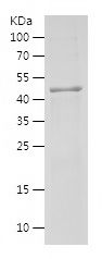    FLCN / Recombinant Human FLCN