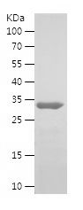    HDGF / Recombinant Human HDGF