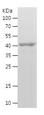    CD105 / Recombinant Human CD105