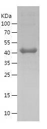    MLH1 / Recombinant Human MLH1