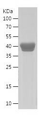    MAGEB4 / Recombinant Human MAGEB4