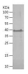    MAGEA8 / Recombinant Human MAGEA8