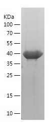    MAGEB18 / Recombinant Human MAGEB18