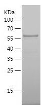    MAGEA10 / Recombinant Human MAGEA10