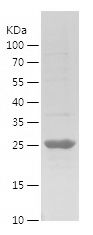    ERCC1 / Recombinant Human ERCC1