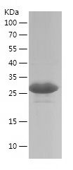    ETV5 / Recombinant Human ETV5