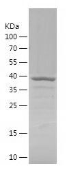    GIPC2 / Recombinant Human GIPC2